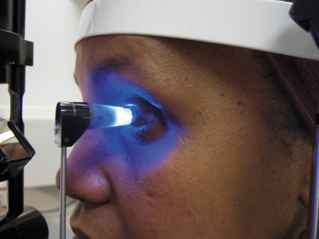 Tonometry - test for glaucoma