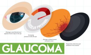 glaucoma and diabetes