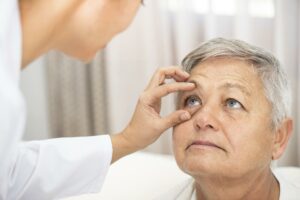 Retinal Pigment Epithelium Tear (RPET) Treatment For Macular Degeneration